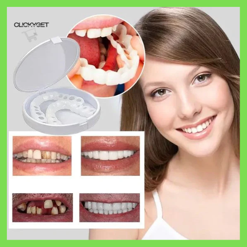 2 X 1 Snapon Smile™ - Carillas Dentales